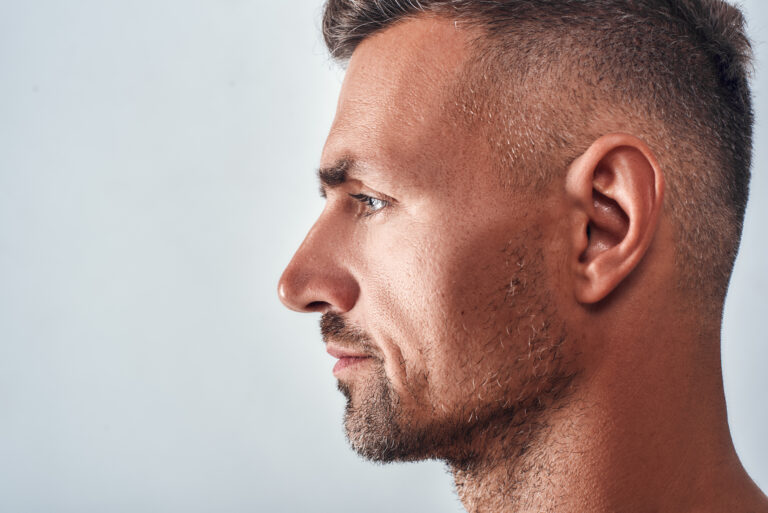 Rhinoplasty Las Vegas