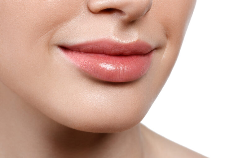 Lip Fillers Las Vegas & Summerlin